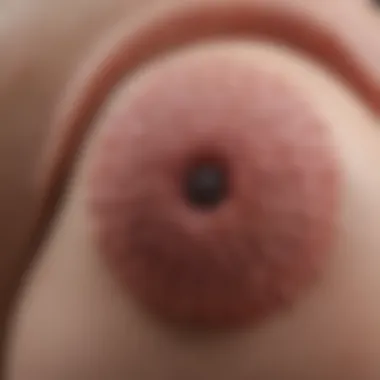 Visual representation of genital warts manifestations on skin