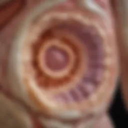 Detailed diagram illustrating the mechanism of ascites formation in colon cancer