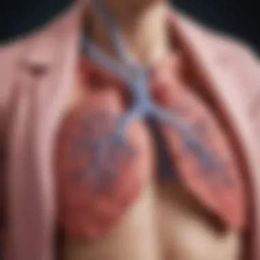 Lung Illustration of Broncho Pulmonary Dysplasia A detailed illustration of the lungs affected by broncho pulmonary dysplasia in a premature infant.