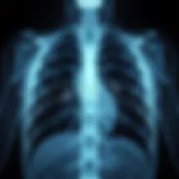 Chest X-ray showcasing tuberculosis lesions