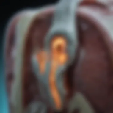 MRI scan showing chronic osteomyelitis