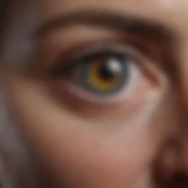 Understanding Macular Degeneration Understanding the complexities of macular degeneration