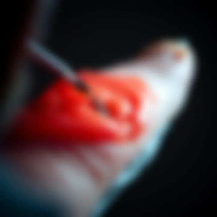 Diagnostic techniques for identifying subungual melanoma