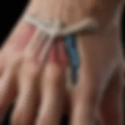 Anatomical illustration depicting the distal joints affected by psoriatic arthritis