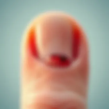 Demonstration of early signs of melanoma under the nail