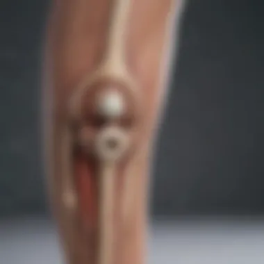 Benefits of Bone Marrow Knee Injections Infographic on benefits of bone marrow injections
