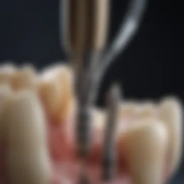Detailed view of endodontic tools used in practice
