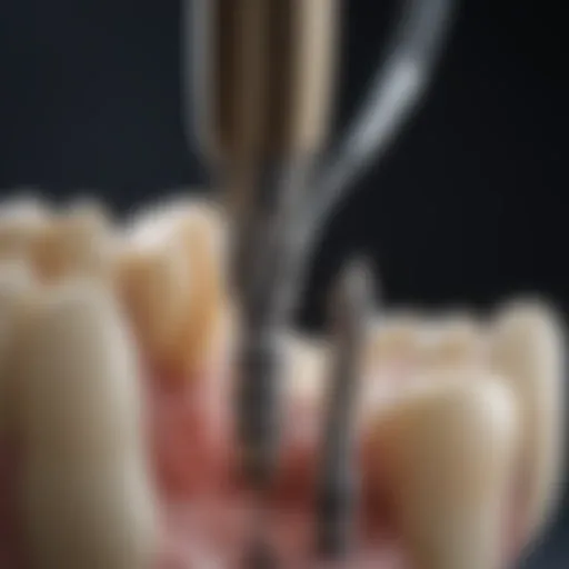Detailed view of endodontic tools used in practice