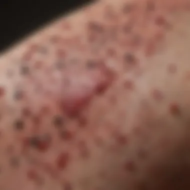 Petechiae Formation in Leukemia Close-up view of petechiae on skin