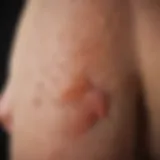 Illustration of skin rashes associated with leukemia