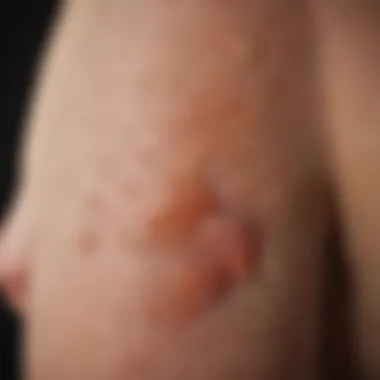 Skin Rashes Linked to Leukemia Illustration of skin rashes associated with leukemia