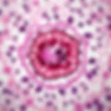 Histological Examination of Ovarian Cancer Histological examination of ovarian cancer tissue