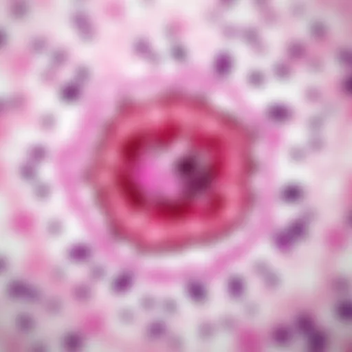 Histological Examination of Ovarian Cancer Histological examination of ovarian cancer tissue