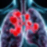 Detailed illustration of lung cancer metastasis showing affected regions
