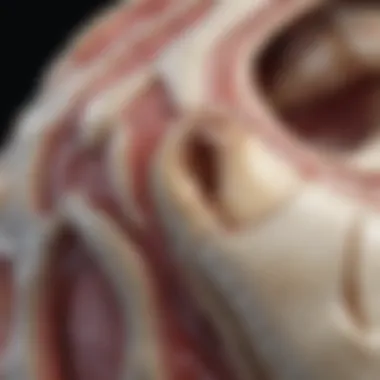 Anatomy of Bone Stress Fracture Anatomy of bone stress fracture showing affected areas