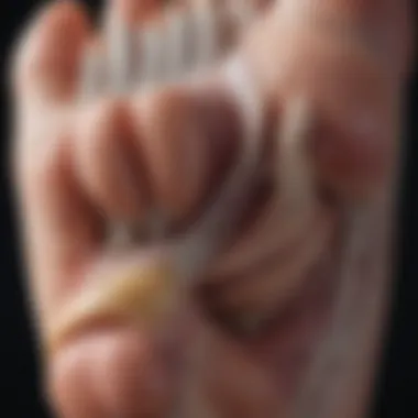 Anatomy of Foot Callouses Illustration showing the anatomical structure of the foot with callouses marked.