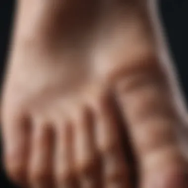Textural Analysis of Foot Callouses Close-up view of foot callouses highlighting their texture and formation.
