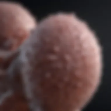 Notable Understanding Gleason 8 Prostate Cancer Notable Understanding Gleason 8 Prostate Cancer
