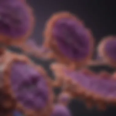 Stages of Pancreatic Cancer Progression Diagram showing the stages of pancreatic cancer progression.
