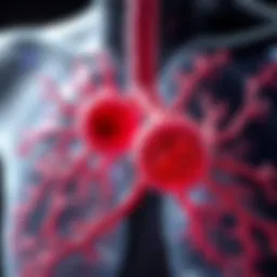 Visual representation of pulmonary arteries affected by embolism