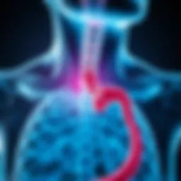 A detailed anatomical illustration of the esophagus highlighting stage one cancer