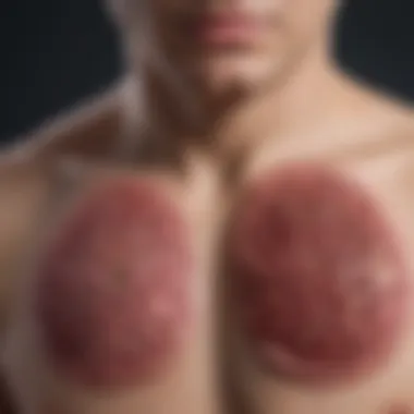 Treatment Options for Staph Infection in the Lungs Visual representation of treatment options for lung staph infections