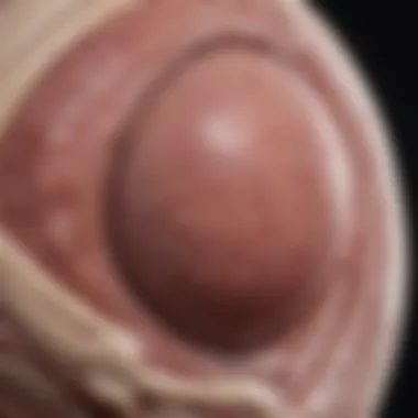 Symptoms of Testicular Seminoma Illustration showing symptoms associated with testicular seminoma