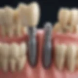 Diagram illustrating different types of dental implants