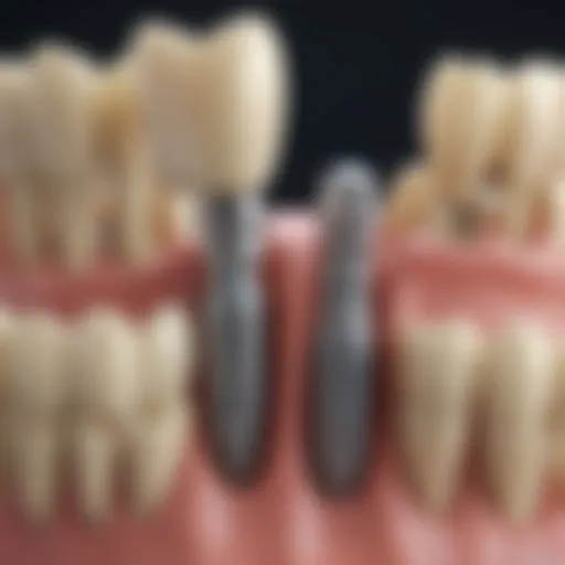Diagram illustrating different types of dental implants