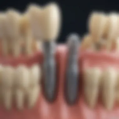 Types of Dental Implants Diagram illustrating different types of dental implants