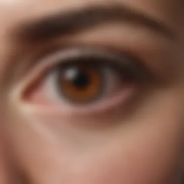 Symptoms of Vein Blockage Diagram showing symptoms of vein blockage in the eye