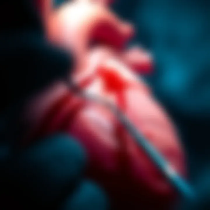 Catheter Maneuvering in VT Ablation Close-up of catheter being maneuvered within the heart during an ablation procedure.